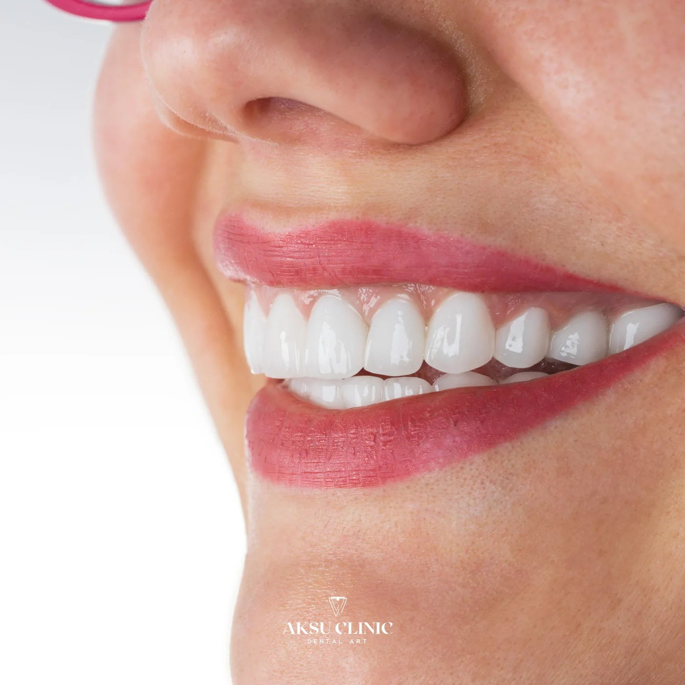 Aksu Clinic 02 099