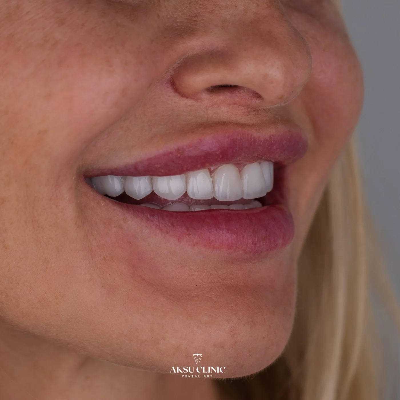 Aksu Clinic 02 1655