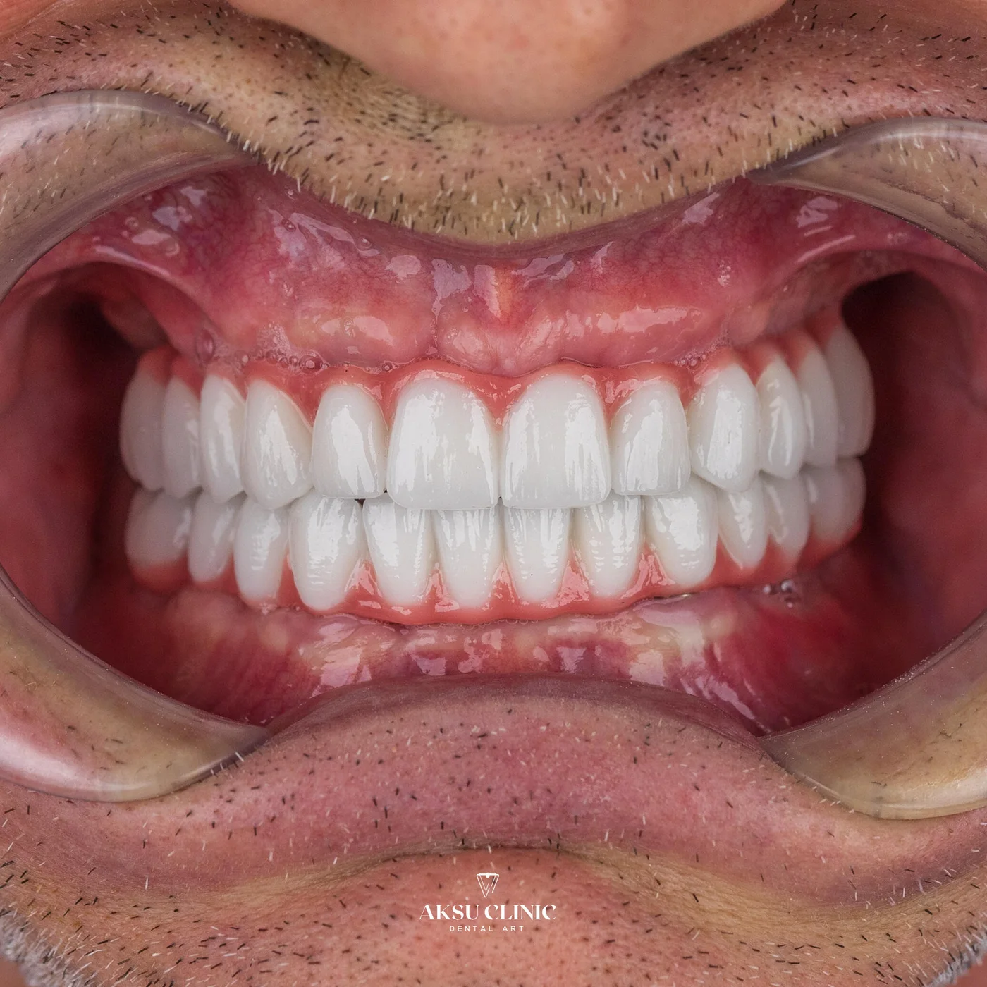 Aksu Clinic 02 1754