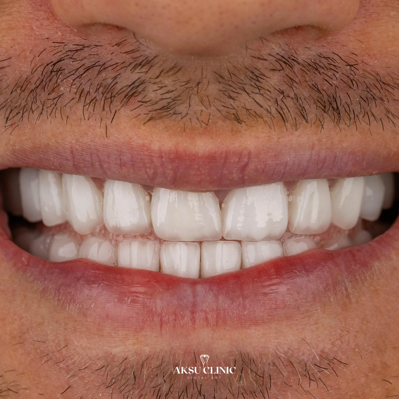 Aksu Clinic D76A9597 1