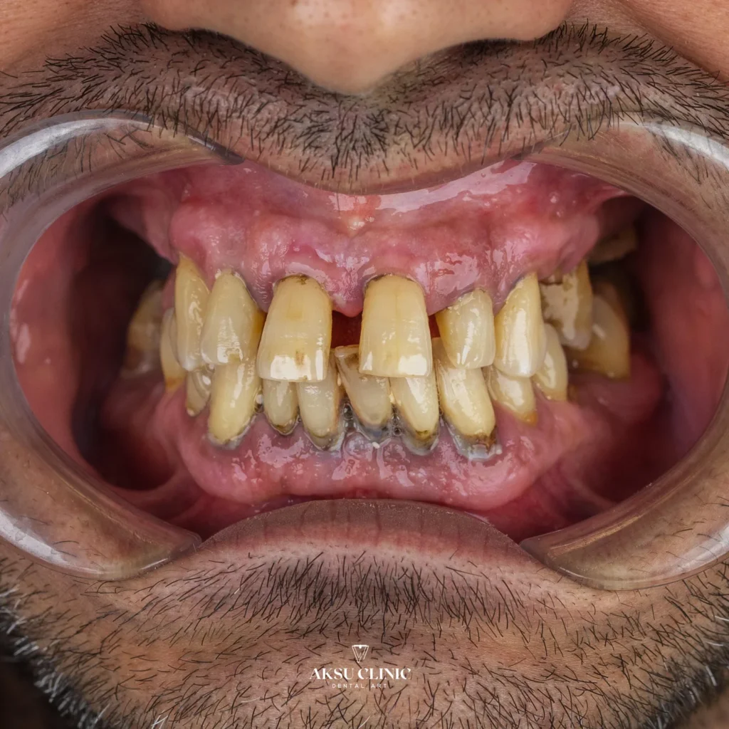 Vaka kaydı 07 — Öncesi