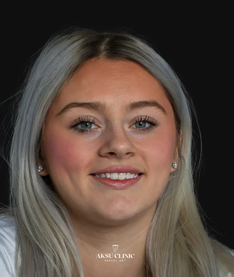 Aksu Clinic Patient Margo Chalmers
