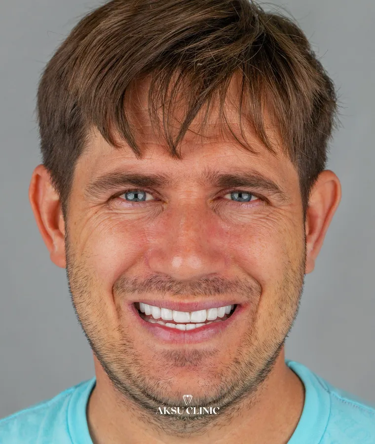 Aksu Clinic Patient Vladimir Trubenko